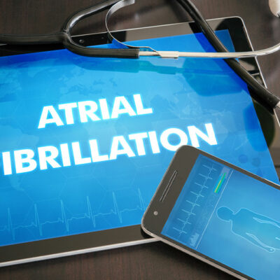 Atrial fibrillation – Causes, symptoms, and management tips