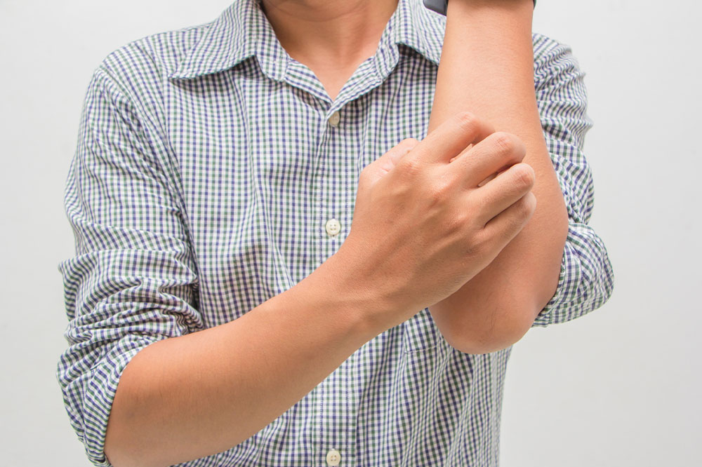 Eczema – Types, symptoms, causes, and management